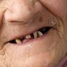 Dientes de indigente