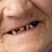 Dientes de indigente